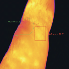 Knee_After