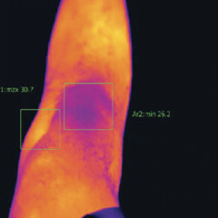 Knee_Before